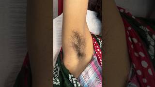 How to Reduce armpit hair growth perfectly skincare waxingexpert waxing waxingathome beauty [upl. by Lyndsay651]