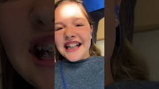 Braces kidslearning kidsfun [upl. by Arim908]