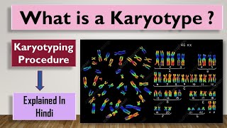 Karyotype  What is a Karyotype and how is it done [upl. by Happ]