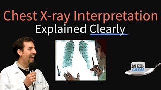 Chest XRay Interpretation Explained Clearly  How to read a CXR [upl. by Geraud378]