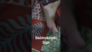 Babinski sign or extensor planter reflex🦶 medical science neuroscience trending [upl. by Hawger837]