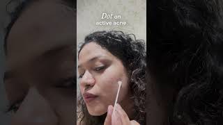 Overnight Acne Spot Corrector  How to Use [upl. by Novj]