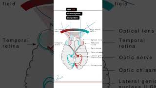 Understanding Homonymous Hemianopia Causes Symptoms and Treatment  Visual Impairment Explained [upl. by Eneloj363]