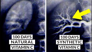 We Finally Know What Type Of Vitamin C Is Best [upl. by Aciram]