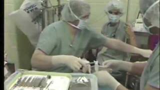 Hospital Dentistry Using General Anesthesia [upl. by Ennairoc378]