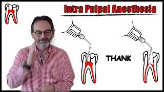 Intra pulpal Anesthesia  The Barbarian Technique الطريقة البربرية لتخدير الأسنان [upl. by Aynotel]