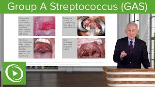 Group A Streptococcus GAS – Infectious Diseases  Lecturio [upl. by Leirol]