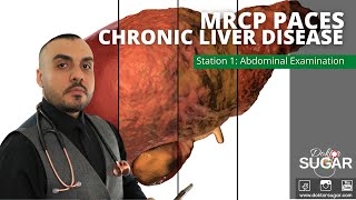 MRCP PACES  Station 1  Chronic Liver Disease [upl. by Nomyar]