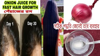 পেঁয়াজ রস100Hair Growthচুল পড়া বন্ধ করে ও নতুন চুল গজায়Onion Juice and coconut oil no hairfall [upl. by Elyk]