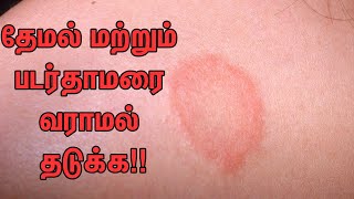 Padarthamarai Marundhu Tamil  Padarthamarai Treatment Tamil  Padarthamarai Thalumbu Maraiya Tips [upl. by Tyre]