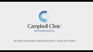 Interlaminar Endoscopic Discectomy at Campbell Clinic Orthopaedics [upl. by Etteiram]