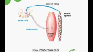 Myofascial Trigger Points Causes and Treatment [upl. by Hobey]