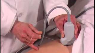 How To Ultrasound Guided Hip Injection Scanning Technique Video [upl. by Chrissy229]