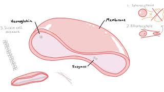 7 Types of Haemolytic Anaemia [upl. by Olette]