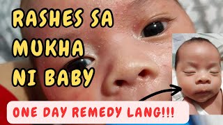 RASHES SA MUKHA ni baby NEONATAL ACNE REMEDY by Dr Pedia Mom [upl. by Ymas800]