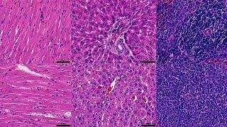 Stable Chitosan Hybrid Coating for Rapid In Situ Bacteria‐Killing under Dual‐Light Irradiation [upl. by Pacheco]