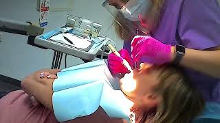 Gently teeth cleaning sensitive teeth  scaling  dentist visit [upl. by Priscilla]