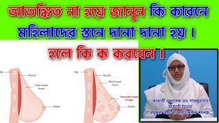 আতঙ্কিত না হয়ে জানুন II Fibrocystic Disease of Breast [upl. by Adriana]