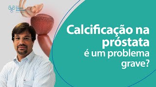 Calcificação na próstata é um problema grave  Dr Cassio Andreoni CRM 78546 [upl. by Hege683]