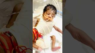 Pneumonia infection newborn baby baby newbornbaby newbornbabymoments [upl. by Hanser]