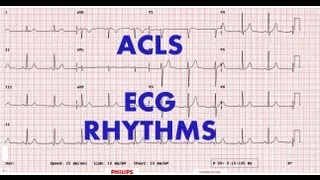 ACLS  ECG rhythm recognition amp management Part 1 [upl. by Nohsed]