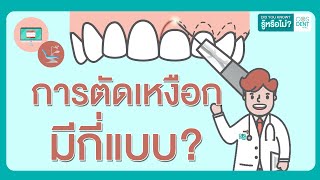 การตัดเหงือกมีกี่แบบ คุณหมอฝากมา ep55  COSDENT SMILE DESIGN [upl. by Enairb]