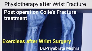 Exercises after wrist surgery  Physiotherapy for Colles fracture wrist stiffness exercises [upl. by Puiia786]