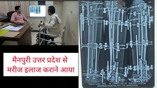 फ्रैक्चर की समस्याओं का समाधान और इलाज nonunion case treatment ACLLigamentFractureIlizarov [upl. by Lehteb]