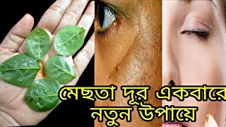 মেছতার দাগ দূর একবারে নতুন ঘরোয়া উপায়  mesta dur korar upay [upl. by Acinot]