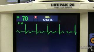 EKG Training Watching and Interpreting the Defibrillator Monitor [upl. by Mok]