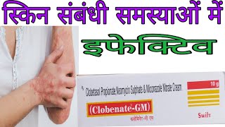 Clobenate  GM cream Uses and side effects in Hindi  क्लोबिनेट जी एम क्रीम की जानकारी [upl. by Michigan26]