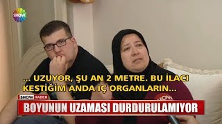 Boyunun uzaması durdulamıyor [upl. by Nynahs]