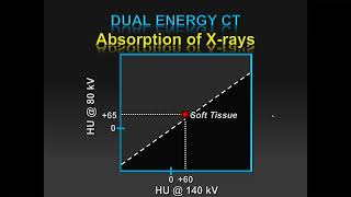 Practical DualEnergy CT Throughout the Body  Course Sample [upl. by Crespi636]