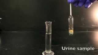 Using a Urinometer [upl. by Eile]