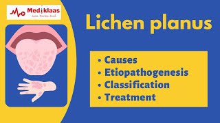 Lichen planus l Causes symptoms treatment l Oral pathology l Mediklaas [upl. by Rostand]