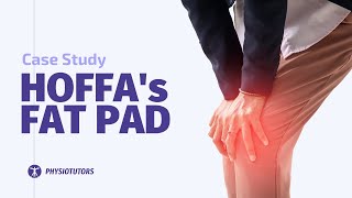 Hoffa Fat Pad Case Study [upl. by Ttevy]