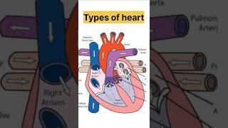 Types of heart tensiongonenotes shorts hearttype [upl. by Bresee]