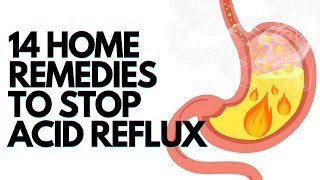 How To Treat Acid Reflux At Home Remedy Treatment For Heartburn [upl. by Ula]