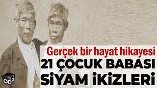 Cinsel hayatları hep merak konusuydu  21 Çocuk babası Siyam İkizleri [upl. by Adnole]