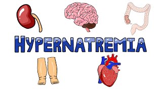 An Approach to Hypernatremia  Hypernatremia Diagnostic Algorithm  Hypernatremia Causes MADE EASY [upl. by Lsil579]