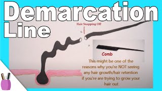 What Is Demarcation Line  Point For Hair  And Breakage [upl. by Freudberg]