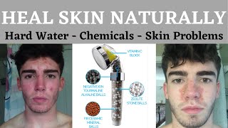 Vitamin C Shower Head Filter For Hard Water and Skin Problems  Natural Skin Care  Caveman Regimen [upl. by Ehsom555]