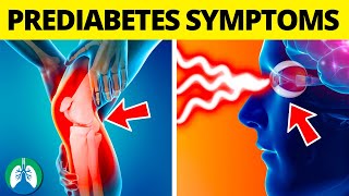 ⚡Top 10 Prediabetes Symptoms You MUST AVOID Reverse Prediabetes [upl. by Indihar]