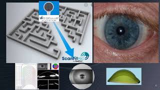 Eye Print Pro Scleral Lens [upl. by Sang]