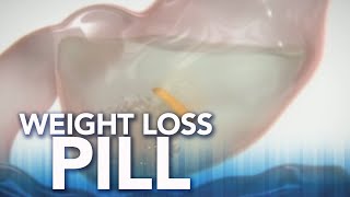 FDA approves new weight loss pill [upl. by Attebasile]