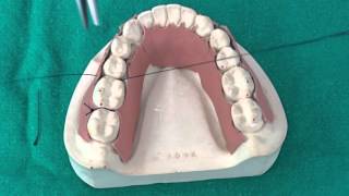 Peridontal Suturing Techniques [upl. by Anirak]