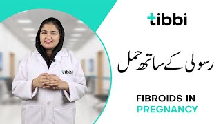 Fibroids and Pregnancy What You Should Know  tibbi [upl. by Sesmar73]