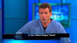 Man survives Black Death after contracting Bubonic Plague in Oregon USA [upl. by Nylhsa485]