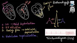 Atrioventricular Septal Defect  AV Canal [upl. by Mariellen]