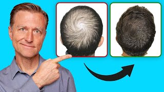 How to Help Regrow Your Hair UPDATED VITAL INFO [upl. by Holbrooke]